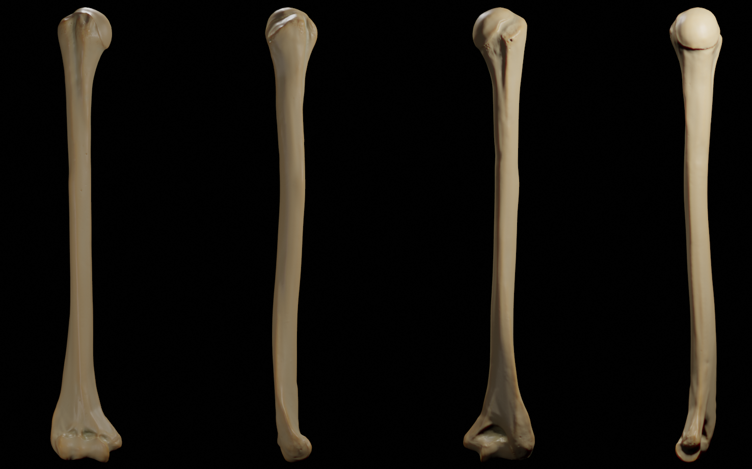 Humerus - Anterior, Posterior, Medial and lateral views