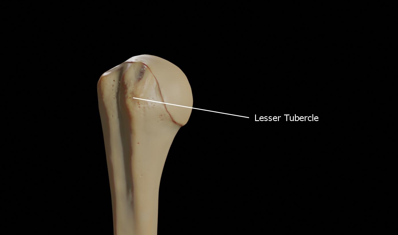 Lesser Tubercle of right humerus