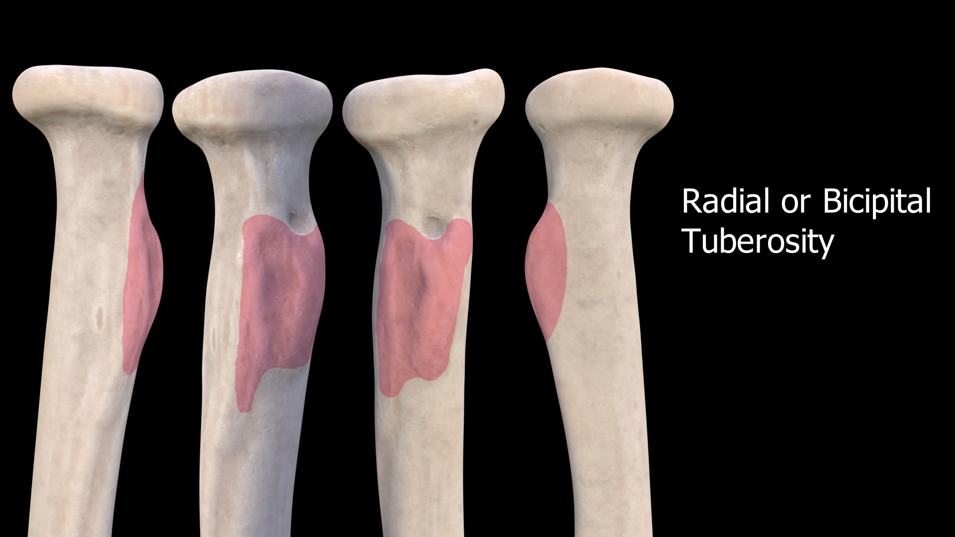 Radial Tuberosity or Bicipital Tuberosity