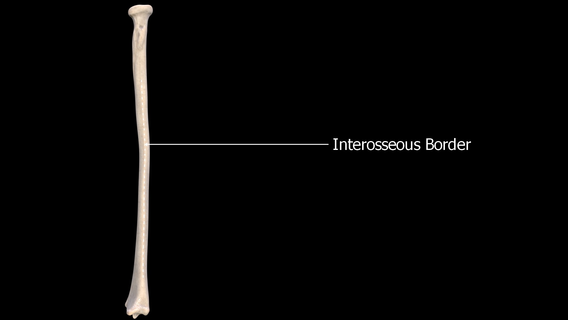 interosseous border is the sharp border on medial aspect, where interosseous membrane is attached