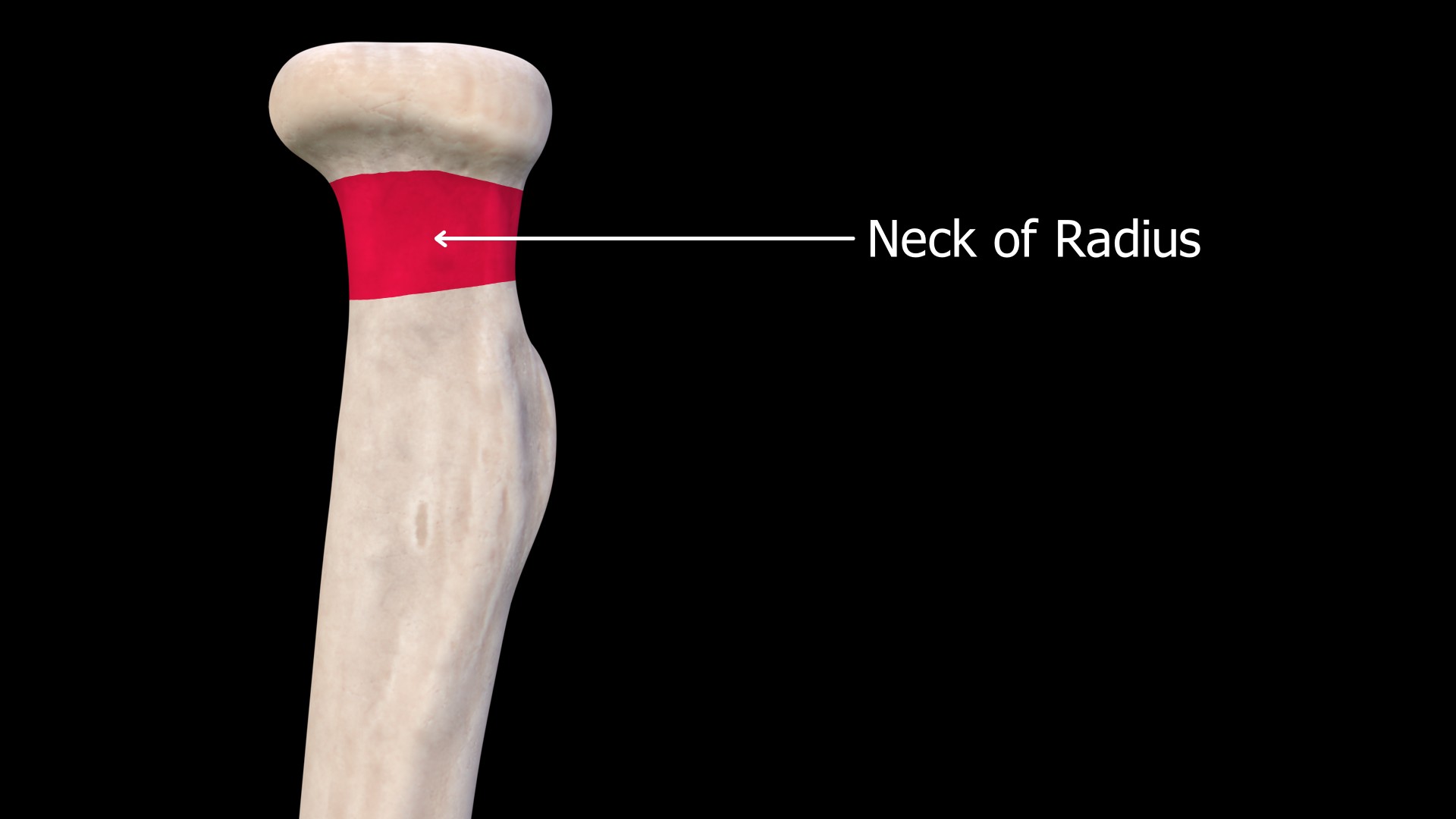 Neck of the radius is between the radial head and radial tuberosity