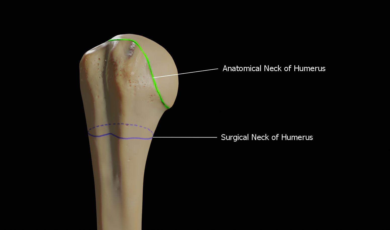 surgical humerus of arm