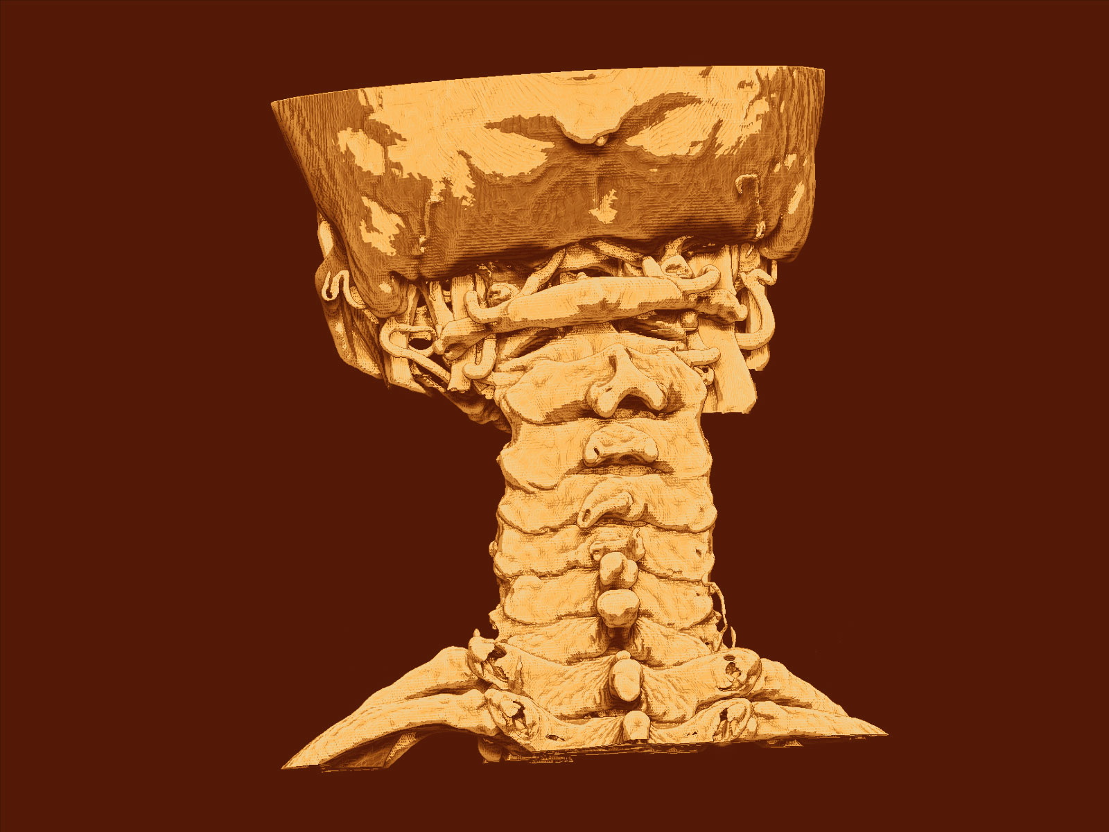 Cervical Vertebrae