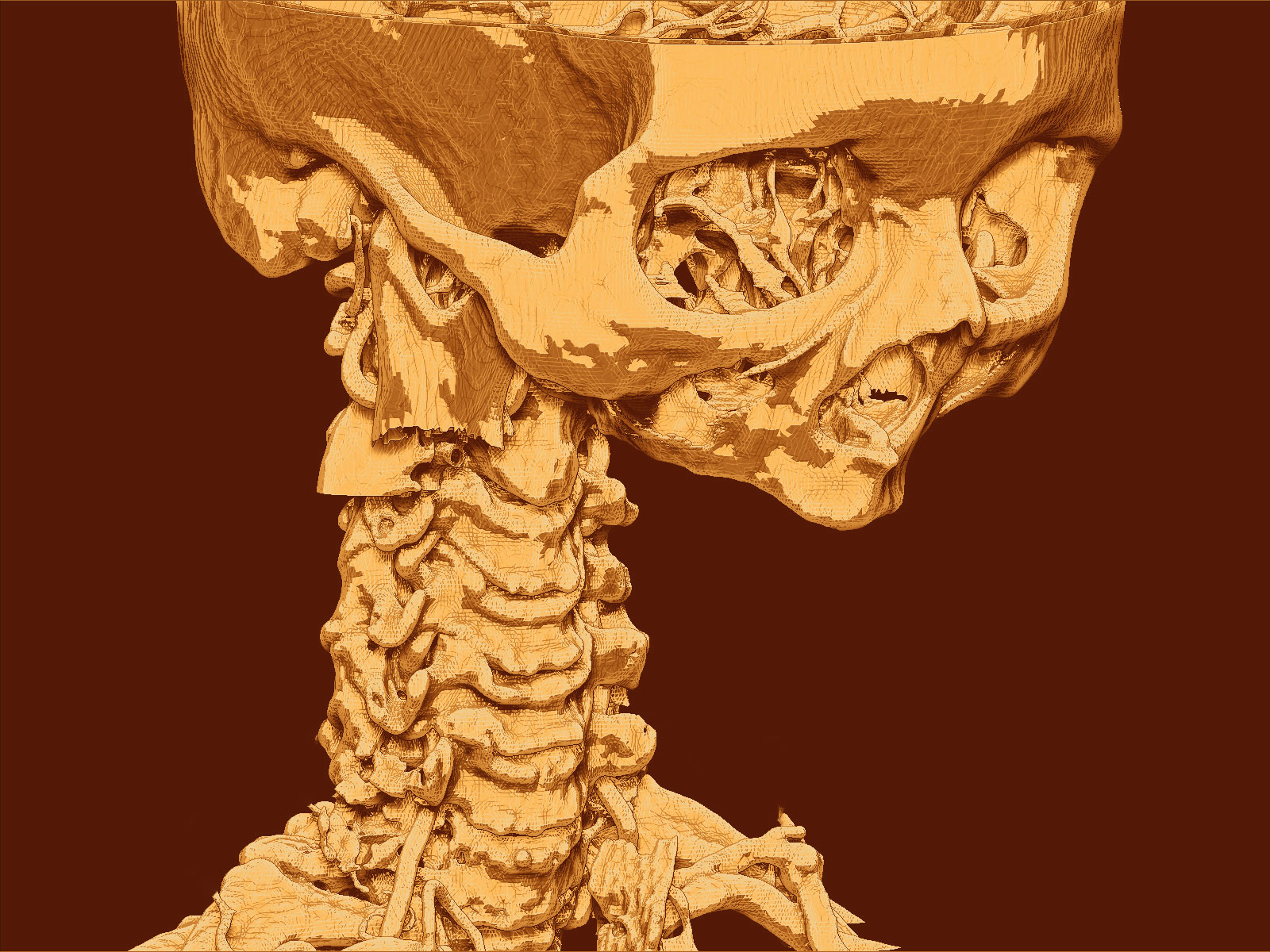 Cervical Vertebrae