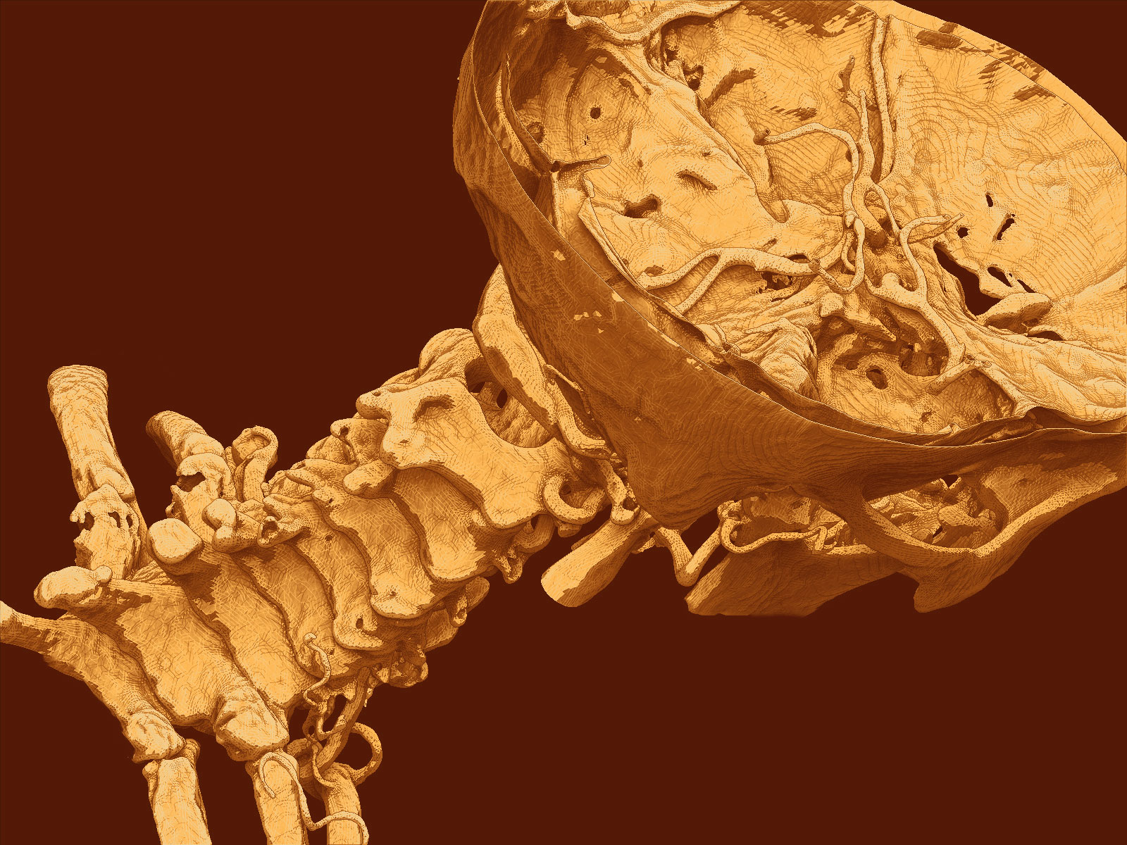 Cervical Vertebrae